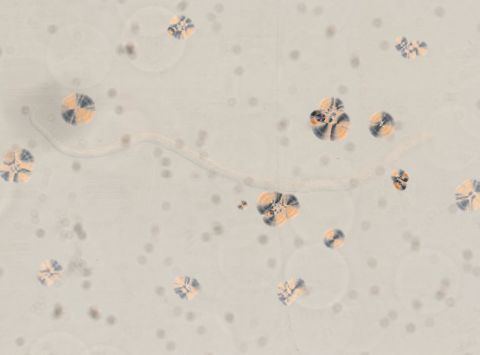 Trichinella spiralis (YPM IZ 095179). Digitales Bild: Yale Peabody Museum, Foto: Daniel J. Drew 25.04.2018, CC0 1.0