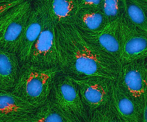 Multiphotonen-Fluoreszenzbild von HeLa-Zellen. Foto: Tom Deerinck, National Institutes of Health, CC BY-NC 2.0